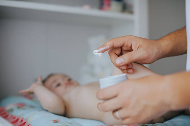 Why Are Diaper Rash Creams Important for Preventing Skin Irritation?
