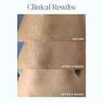 Evereden Golden Belly Serum, 1.7 fl oz. & Nourishing Stretch Mark Cream 4.0 fl oz. | 2 Item Bundle Set | Maternity Skincare