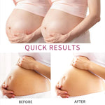 Stretch Marks Removal - Postpartum Essentials - Pregnancy Must Haves - Stretch Mark Cream，Massage Milk,Oil,Body Wash - Skin Care Kit, Spring Gifts for Women, Anti Wrinkle,Enhance Skin Elasticity