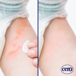 Crema Cero Diaper Rash Cream for Baby With Zinc Oxide – High-Strength Diaper Cream for Quick Relief and Protection – Hydrating and Soothing Baby Balm – 3.9oz