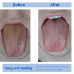 Genco Dental Tongue Scraper for Fresh Breath Perfect Tongue Scraper for Adults and Kids, Enhance Your Oral Hygiene with Tongue Brushes, Scrapers for Bad Breath Treatment (1 Pack (Scraper))