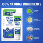 Stretch Mark Cream for Pregnancy, Helps Stretch Marks Removal, Smooth and Firm the Belly Skin, Abdominal Care for Preventing and Repairing Wrinkles and Scars, Gentle Treatment for Mom