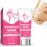 Stretch Marks Removal, Safe and Gentle Formula Stretch Mark Cream for Pregnancy, Pregnancy Stretch Mark Prevention Cream, Improve Skin Appearance and Elasticity