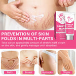 Stretch Marks Removal, Safe and Gentle Formula Stretch Mark Cream for Pregnancy, Pregnancy Stretch Mark Prevention Cream, Improve Skin Appearance and Elasticity