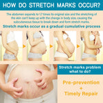 Stretch Mark Cream for Pregnancy - Deep Repair & Prevention for Stretch Marks - Stretch Mark Oil/Lotion for Women - Prenatal & Postnatal Skin Care (1-Pack)
