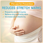 Stretch Mark Cream for Pregnancy - Deep Repair & Prevention for Stretch Marks - Stretch Mark Oil/Lotion for Women - Prenatal & Postnatal Skin Care (1-Pack)