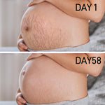 Stretch Mark Cream for Pregnancy - Deep Repair & Prevention for Stretch Marks - Stretch Mark Oil/Lotion for Women - Prenatal & Postnatal Skin Care (1-Pack)