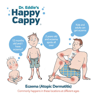 Happy Cappy Baby Shampoo and Body Wash - Eczema Body Wash for Kids, Toddler, Adults, Helps with Dryness, Reduces Itching, Irritation, and Redness, Dermatologist Tested, Fragrance Free - 8 Fl Oz