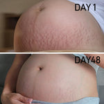Stretch Mark Cream for Pregnancy - Deep Repair & Prevention for Stretch Marks - Stretch Mark Oil/Lotion for Women - Prenatal & Postnatal Skin Care (1-Pack)