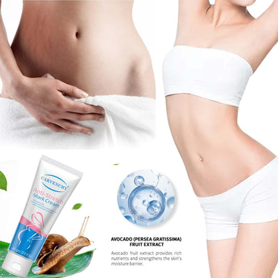 Ezyuanchly Stretch Mark Cream for Women,Scar Cream Body Moisturizer, Reduce The Look of Scars and Stretch Marks,Body Tightening Cream for Scars & Stretchmarks, All Skin Types