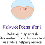 Desitin Daily Defense Baby Diaper Rash Cream with Zinc Oxide to Treat, Relieve & Prevent diaper rash, Hypoallergenic, Dye-, Phthalate- & Paraben-Free, 4 oz