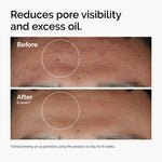 The Ordinary Niacinamide 10% + Zinc 1%, Smoothing Serum for Blemish-Prone Skin, 1 Fl Oz